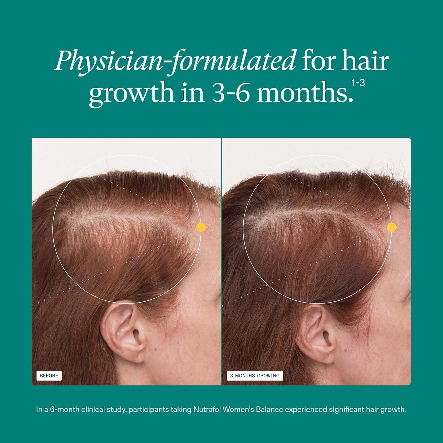 Nutrafol Women's Balance Hair Growth Supplements