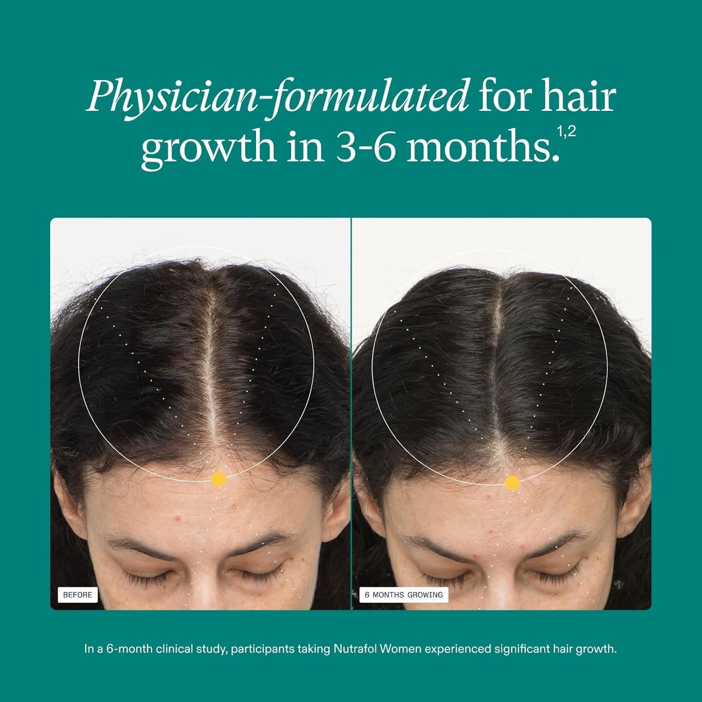 Nutrafol Women Hair Growth Supplements, Ages 18-44, 1-Month Bottle