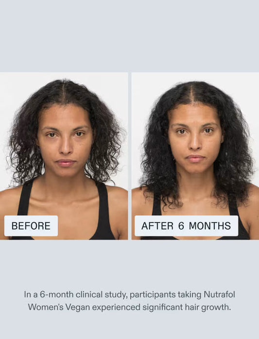 Nutrafol Women Hair Growth Nutraceutical|Daily Hair Growth Supplement for Women Ages 18–44
